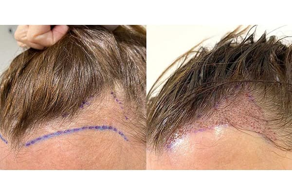BeforeAfter Results img