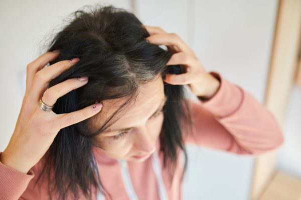 hair-transplant-for-women-1