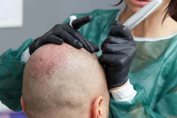 hair-treatments-4